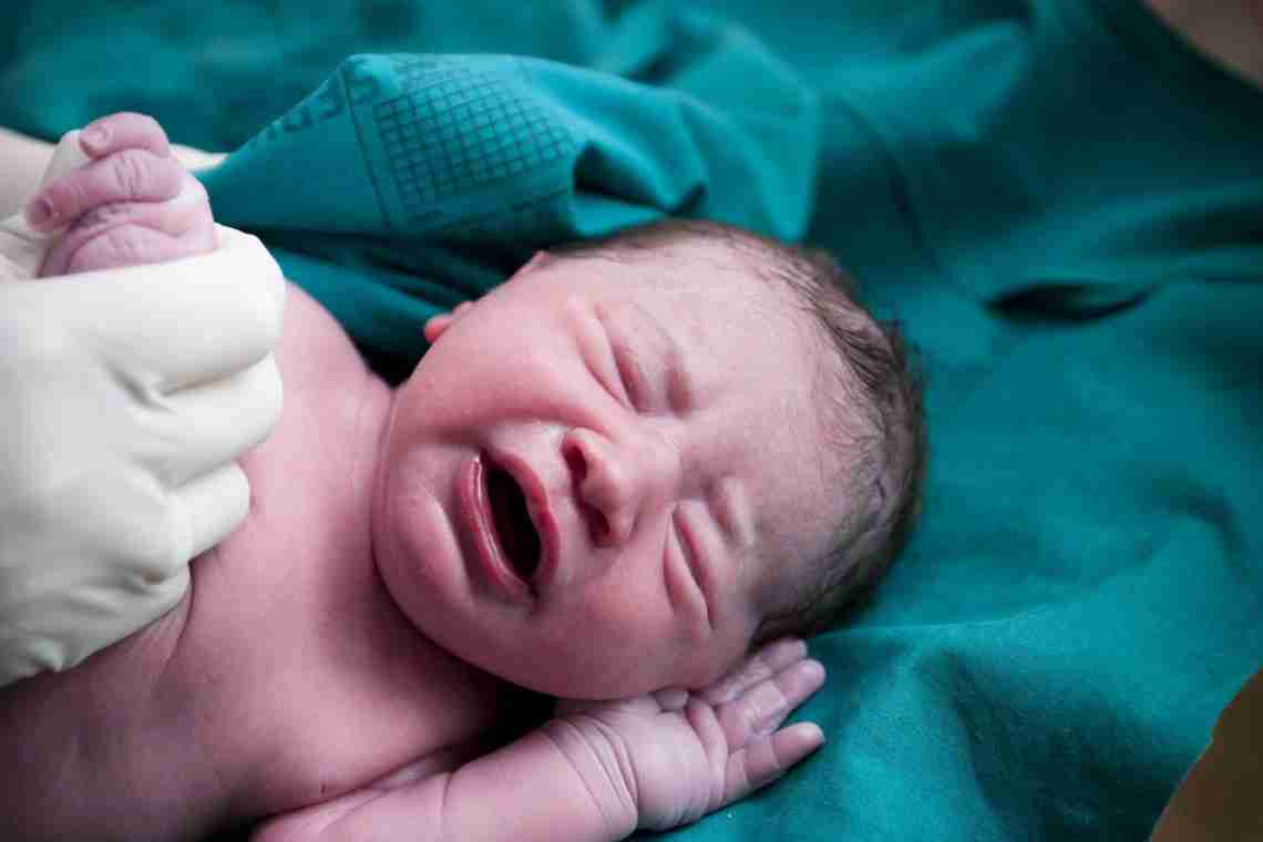 Лікування асфіксії новонароджених