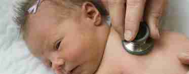 Судоми у новонароджених: основні симптоми та лікування