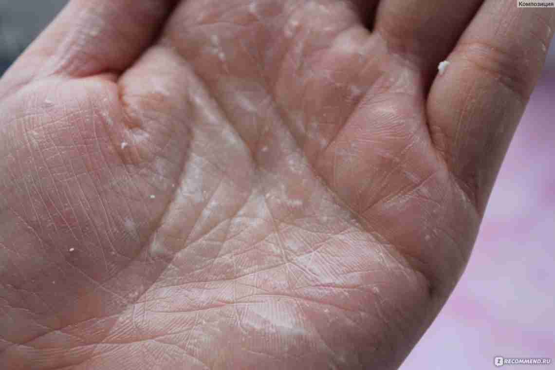 Чому між пальцями ніг і рук у дитини облазить шкіра? Причини та шляхи боротьби з захворюванням