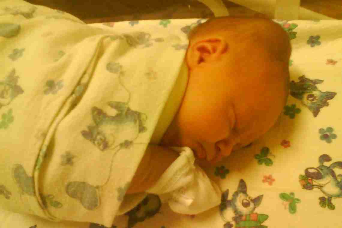 Кефалогематома на голові у новонародженого: причини виникнення та наслідки травми