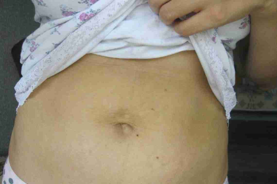Самомасаж живота: прибираємо жировий фартук після вагітності та пологів