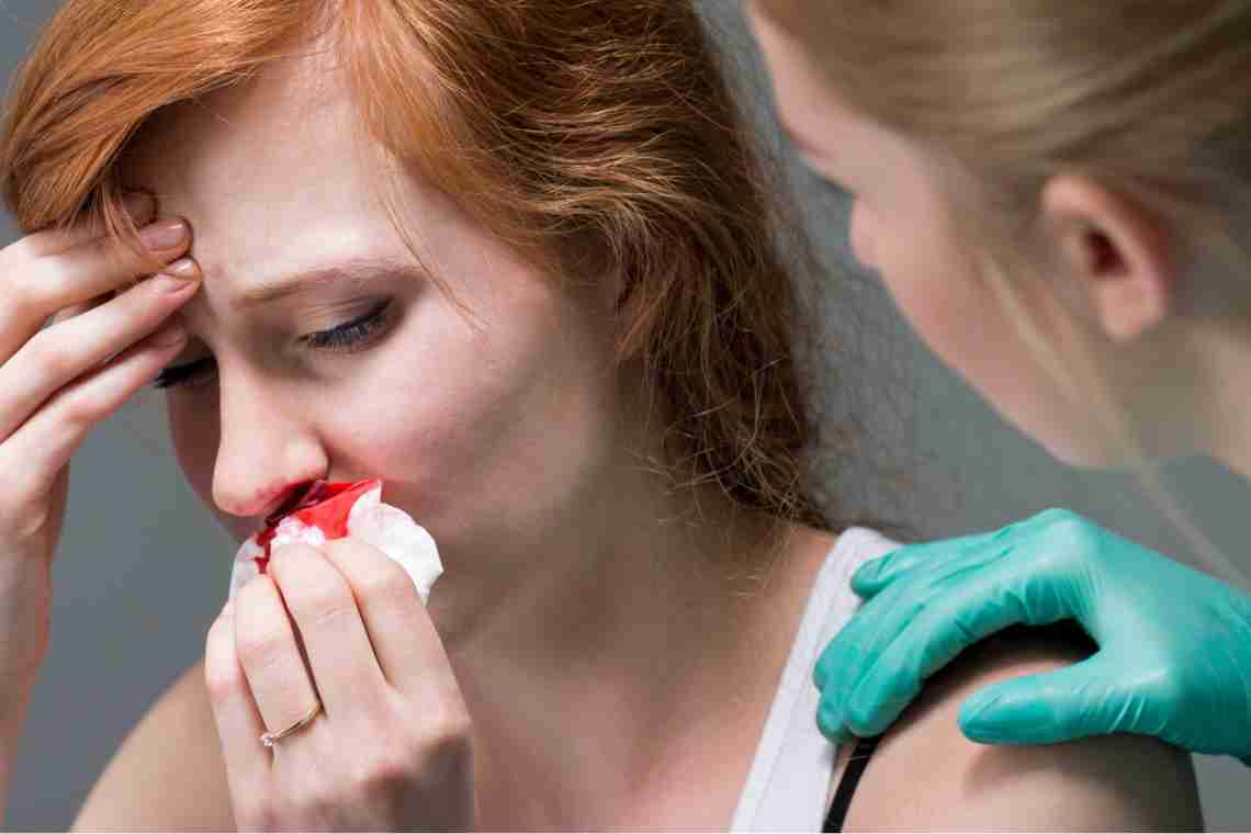 Кров з носа під час вагітності: чи є привід для занепокоєння?