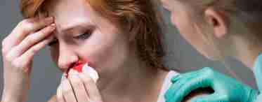 Кров з носа під час вагітності: чи є привід для занепокоєння?