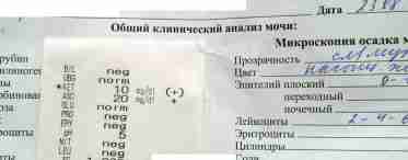 Бак посів сечі при вагітності: як здати аналіз і розшифрувати результати