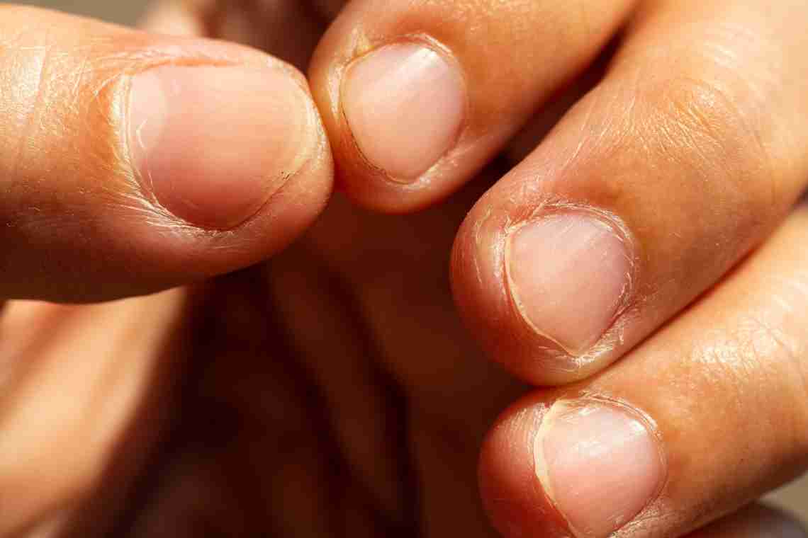 Легкий спосіб кинути гризти нігті
