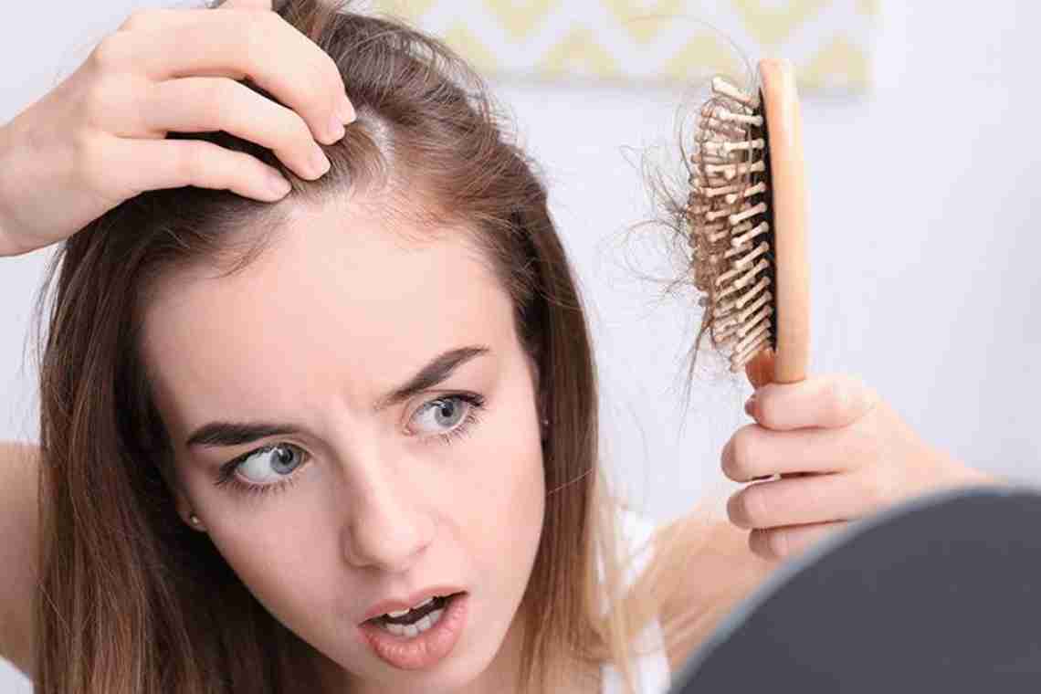 Як зупинити випадання волосся у жінок?