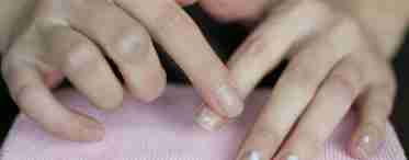 Ребристі нігті на руках: причини та способи усунення проблеми