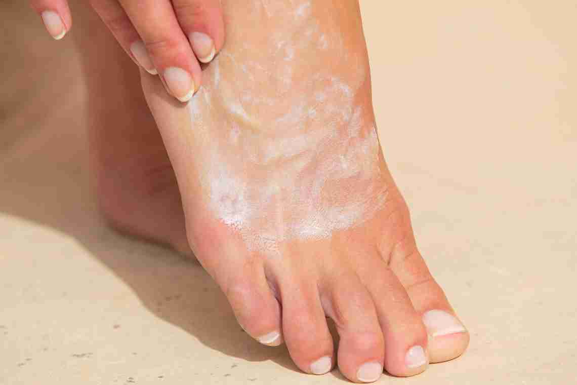 Сохне шкіра на ногах: причини та лікування