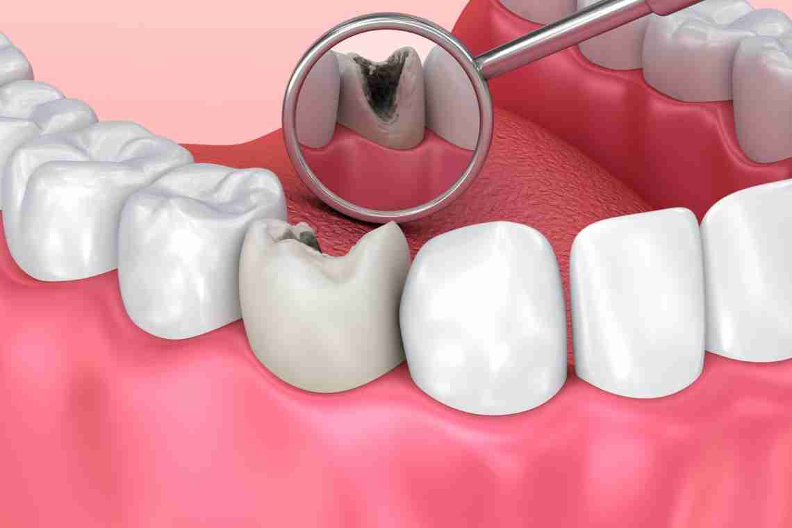 Ломить зуби - в чому може бути причина?