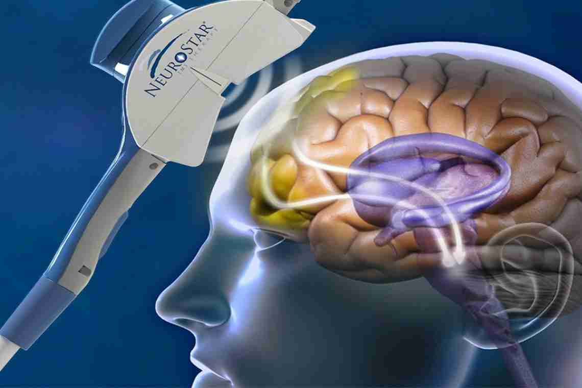 Які причини зменшення мозку сучасної людини