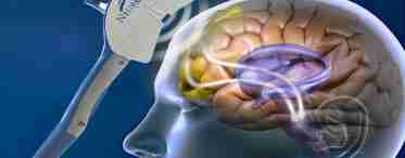 Які причини зменшення мозку сучасної людини