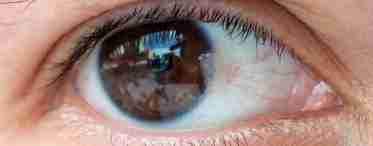 Чому утворюється плівка на очах у людини: лікування та профілактика