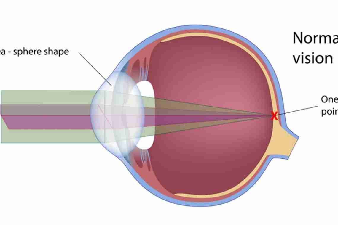 Різний зір у правому і лівому оці - чому таке відбувається і як це виправити?