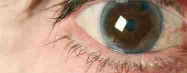 Скляні очі: що означає симптом і як з ним боротися