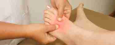 На ногах набряки і червоні плями: причини та грамотне лікування