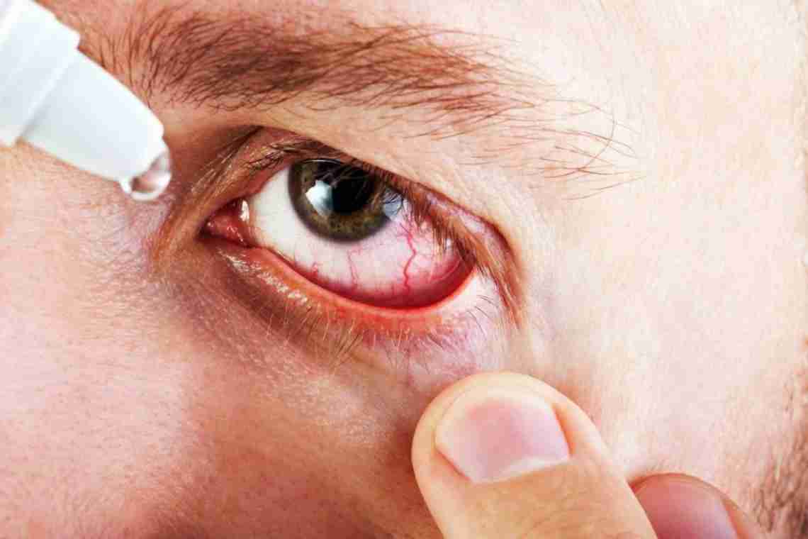 Чому тисне на очі: можливі причини симптому