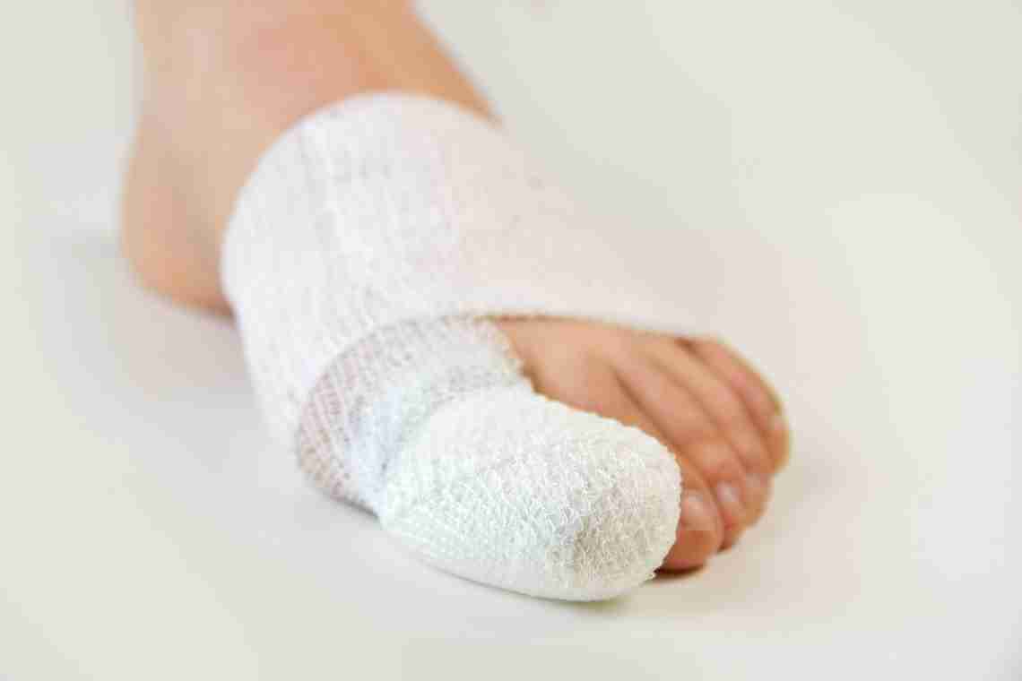 Забої пальців ніг: перша допомога і лікування