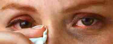 Боремося з кон'юнктивітом: чим промити очі при недузі