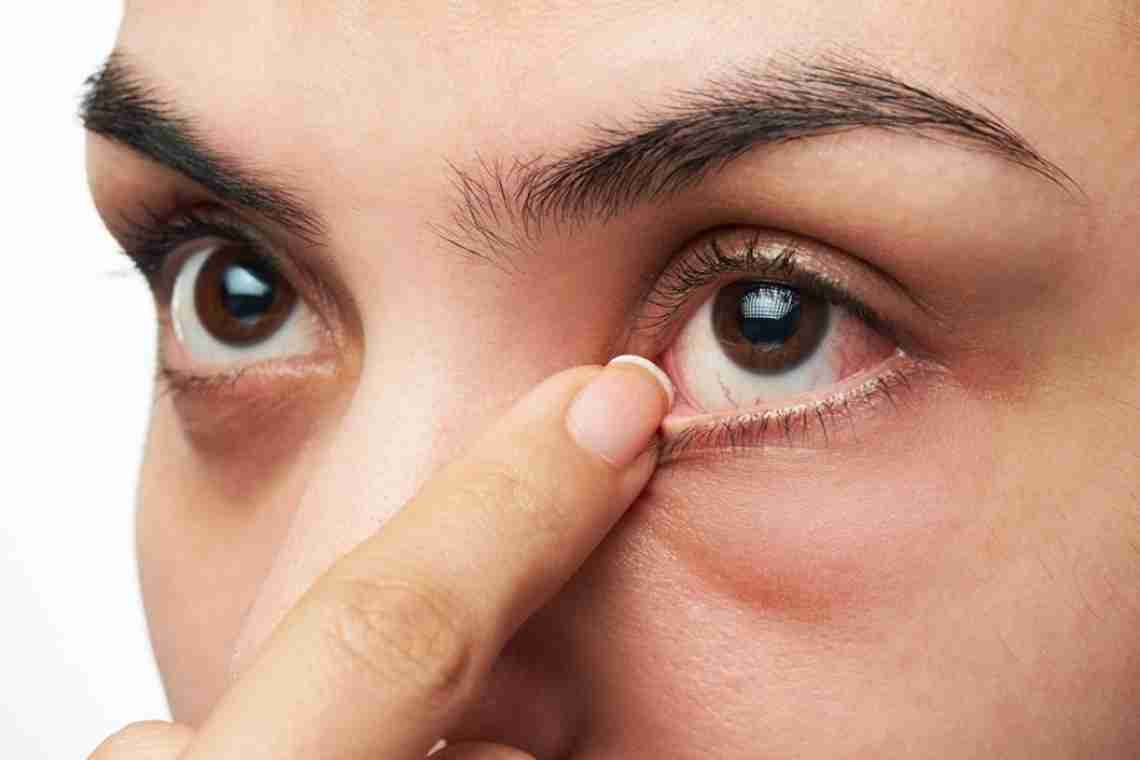 Плівка на очах у людини: причини появи та методи її усунення
