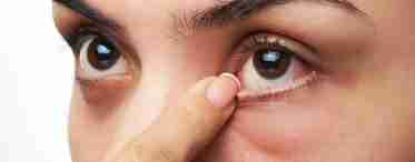Плівка на очах у людини: причини появи та методи її усунення