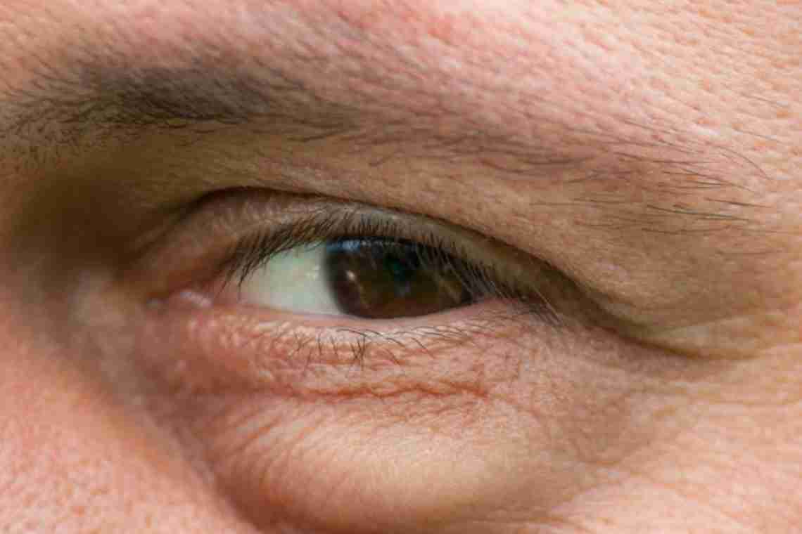 Чорні точки в очах: причини та лікування