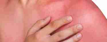 Волдирі на шкірі з рідиною: захворювання, якими вони викликані