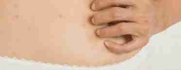 Хвороби, які супроводжуються появою висипу на спині у дорослих