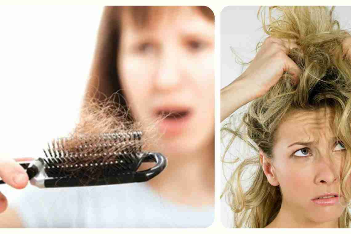 Основні причини, що провокують подразнення шкіри голови та способи позбавлення від проблеми