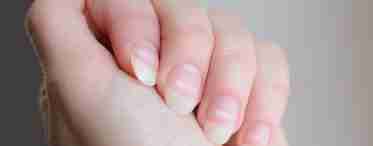 Чому на нігтях з'являються білі плями