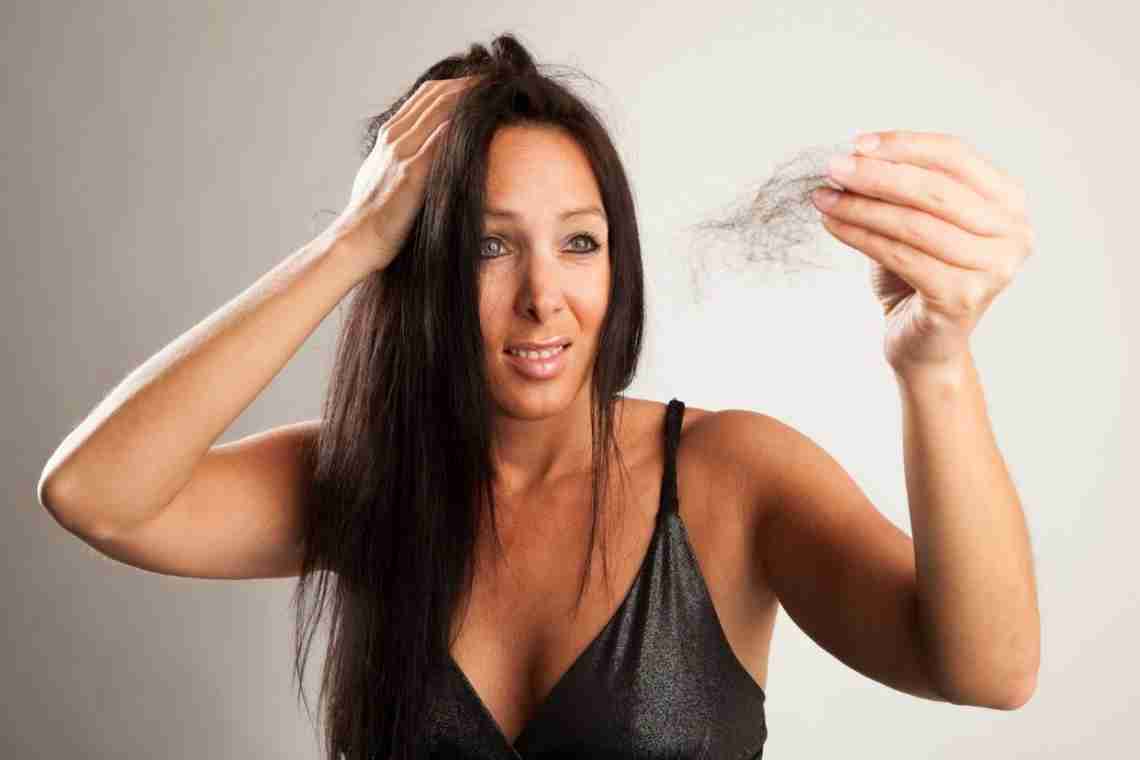 Випадання волосся у жінок