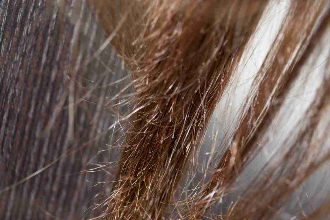 Ламкість волосся біля коріння - рятуємо шевелюру!