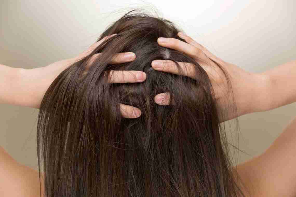 Лікуємо випадання волосся і перхоти ефективними домашніми засобами