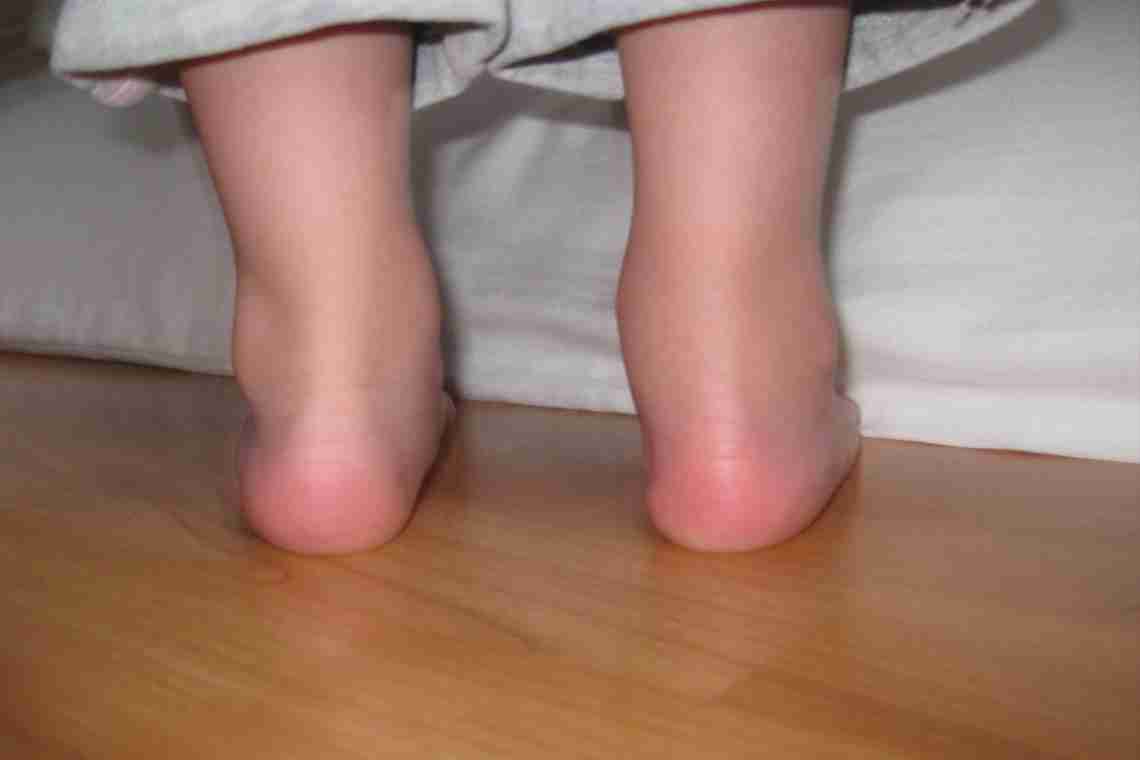 Поява почервоніння між ніг у дитини