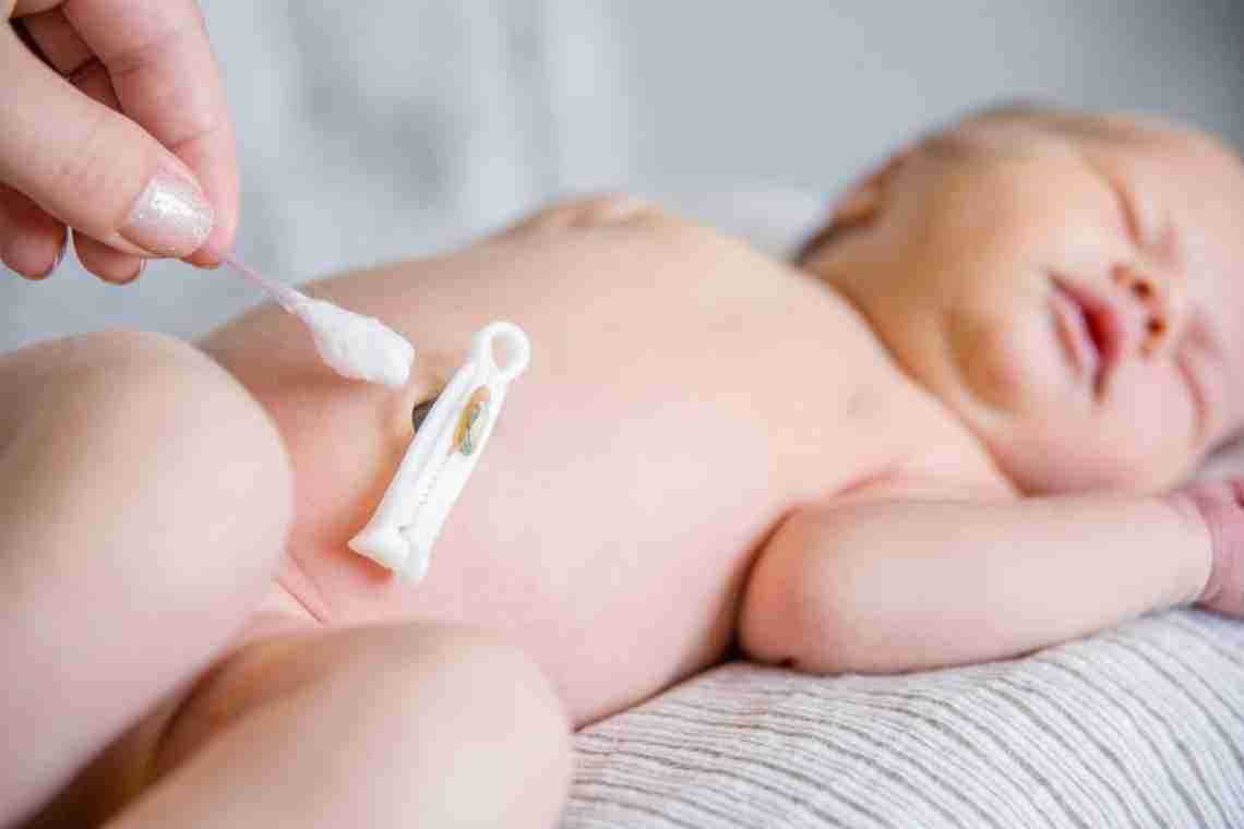 Коли відпадає пуповина у новонародженого і як за нею правильно доглядати?
