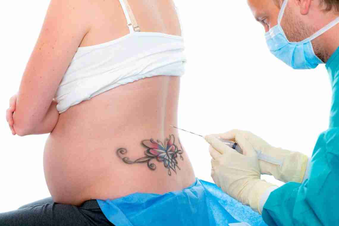 Анестезія при вагітності: ризики виникнення ускладнень