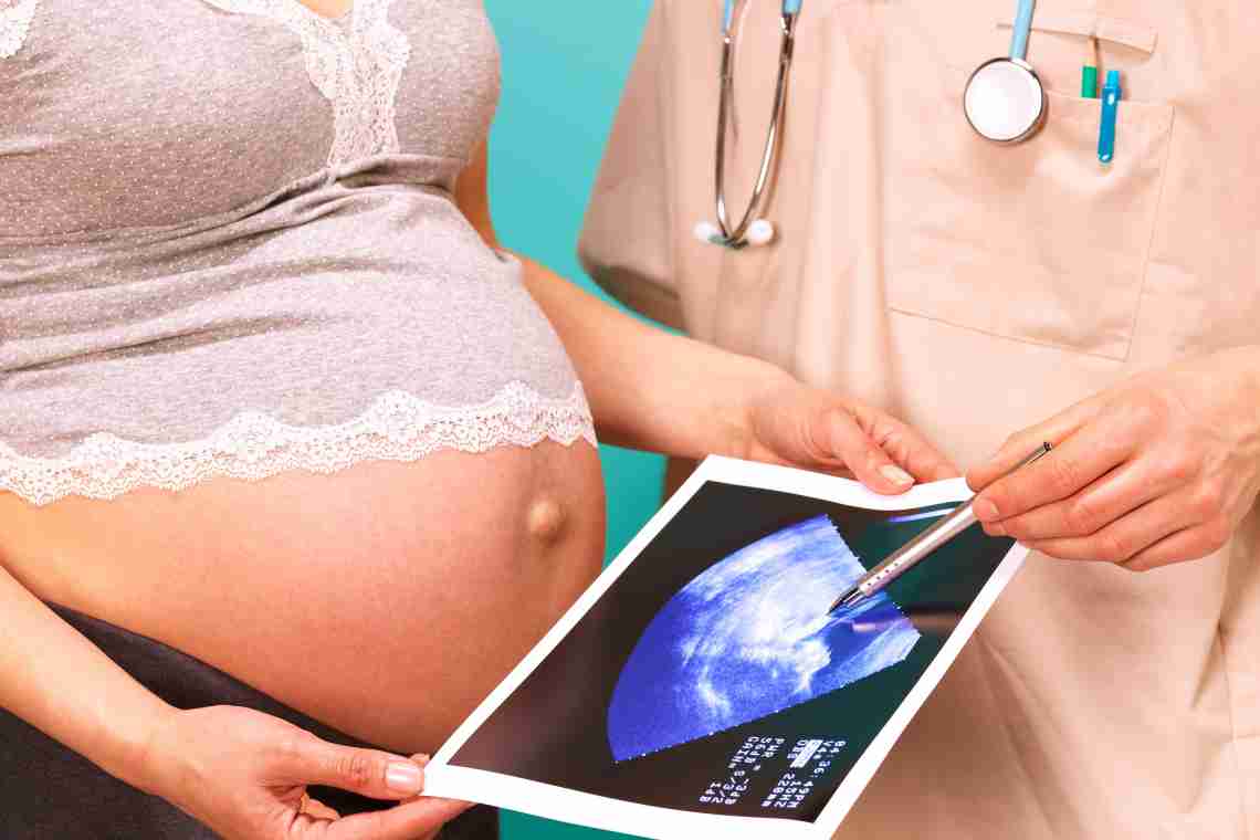 Помірне багатоводіння при вагітності