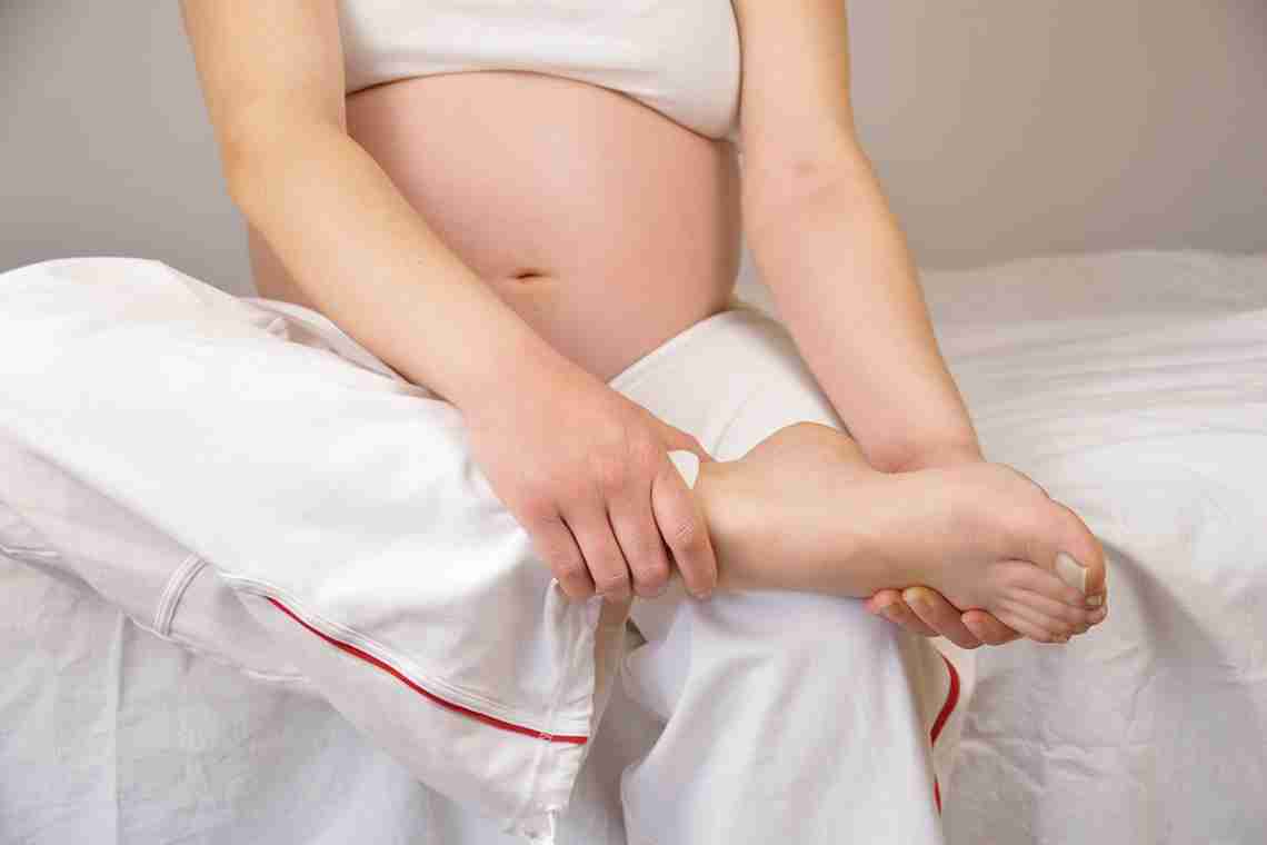 Як усунути набряки при вагітності?