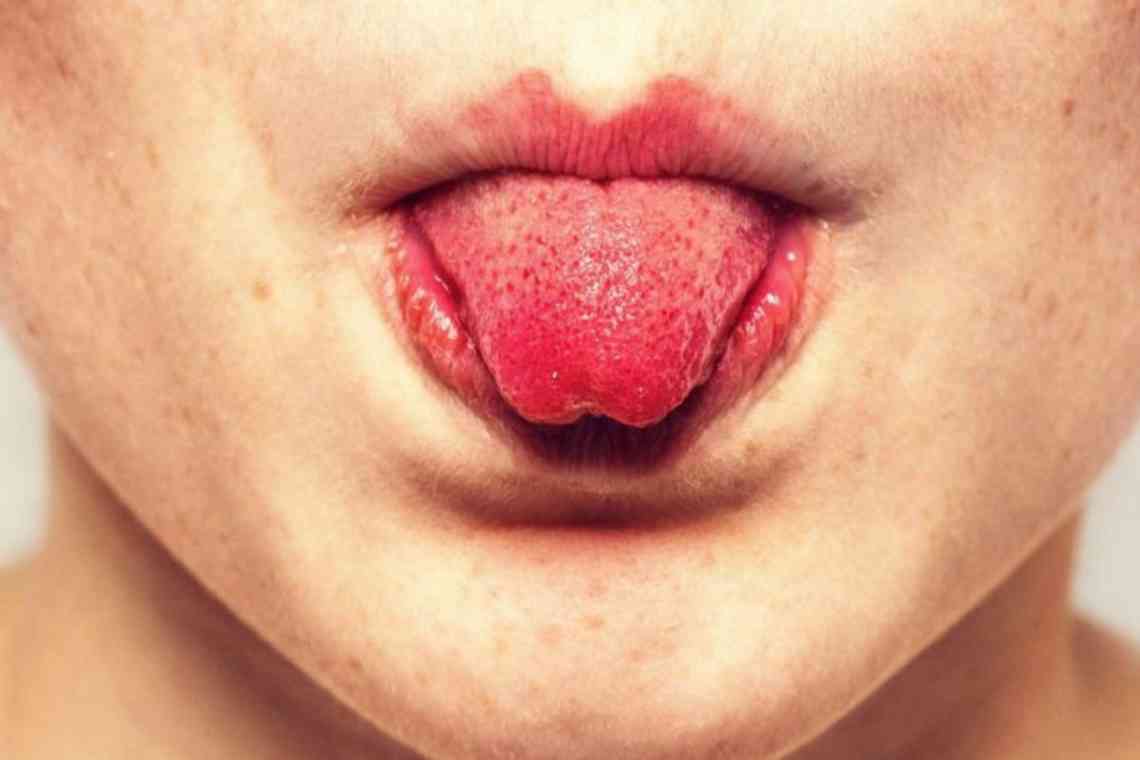 Причини смаку крові в роті