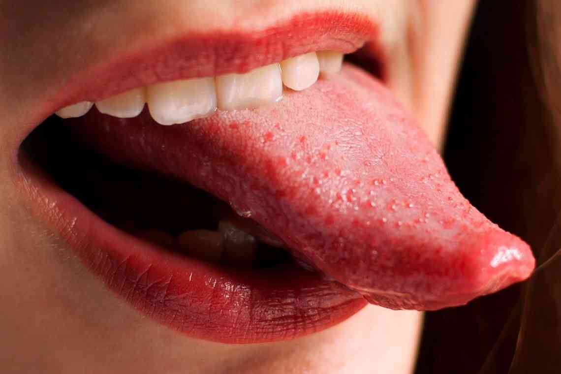 Причини появи кислого присмаку в роті