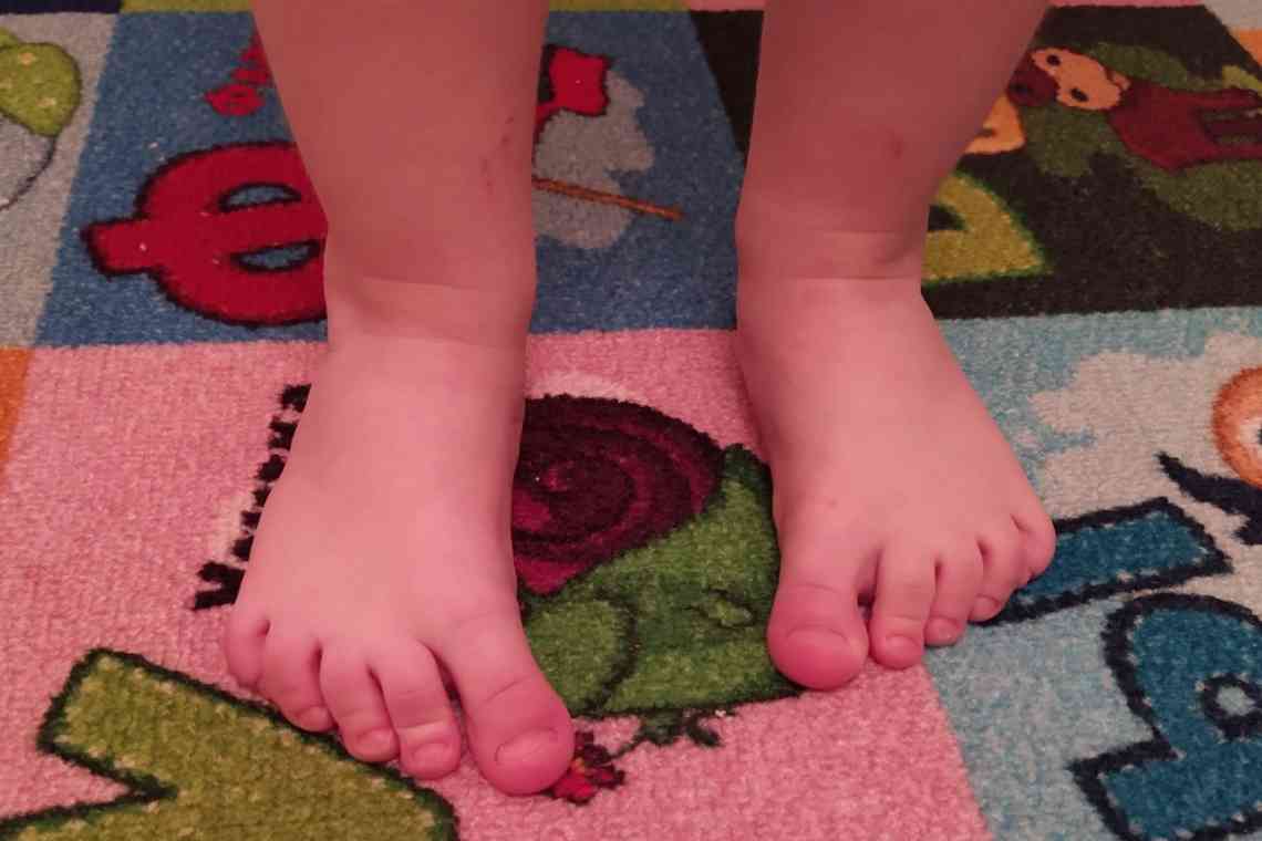 Що робити, коли у маленької дитини одна нога коротша за іншу?