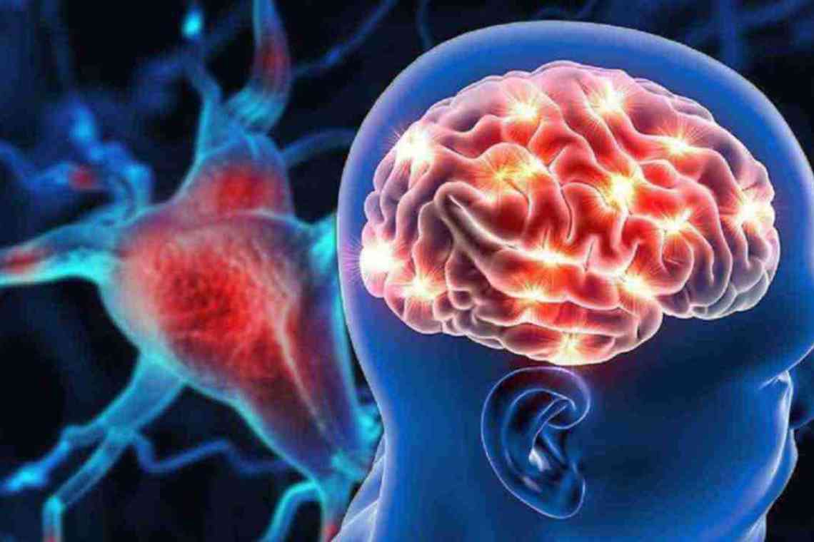 Чим загрожує порушення кровообігу головного мозку?