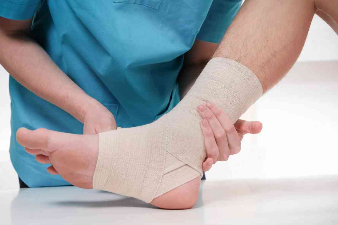 Розтягнення м'язів на нозі: як надати першу допомогу?