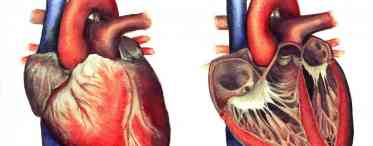 Що робити при аневризмі області серця?