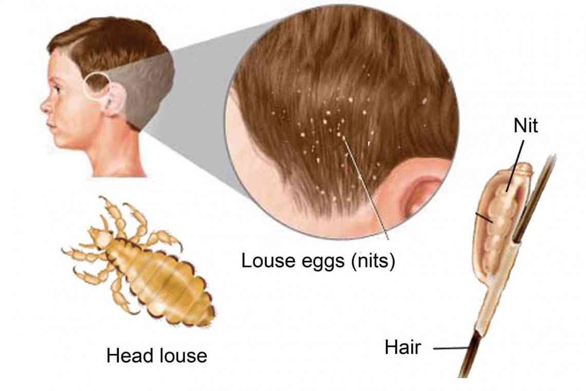 Головні і платяні вші і гниди: інкубаційний період паразитів