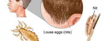 Головні і платяні вші і гниди: інкубаційний період паразитів