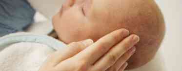 Мармурова шкіра у дітей: причина і лікування