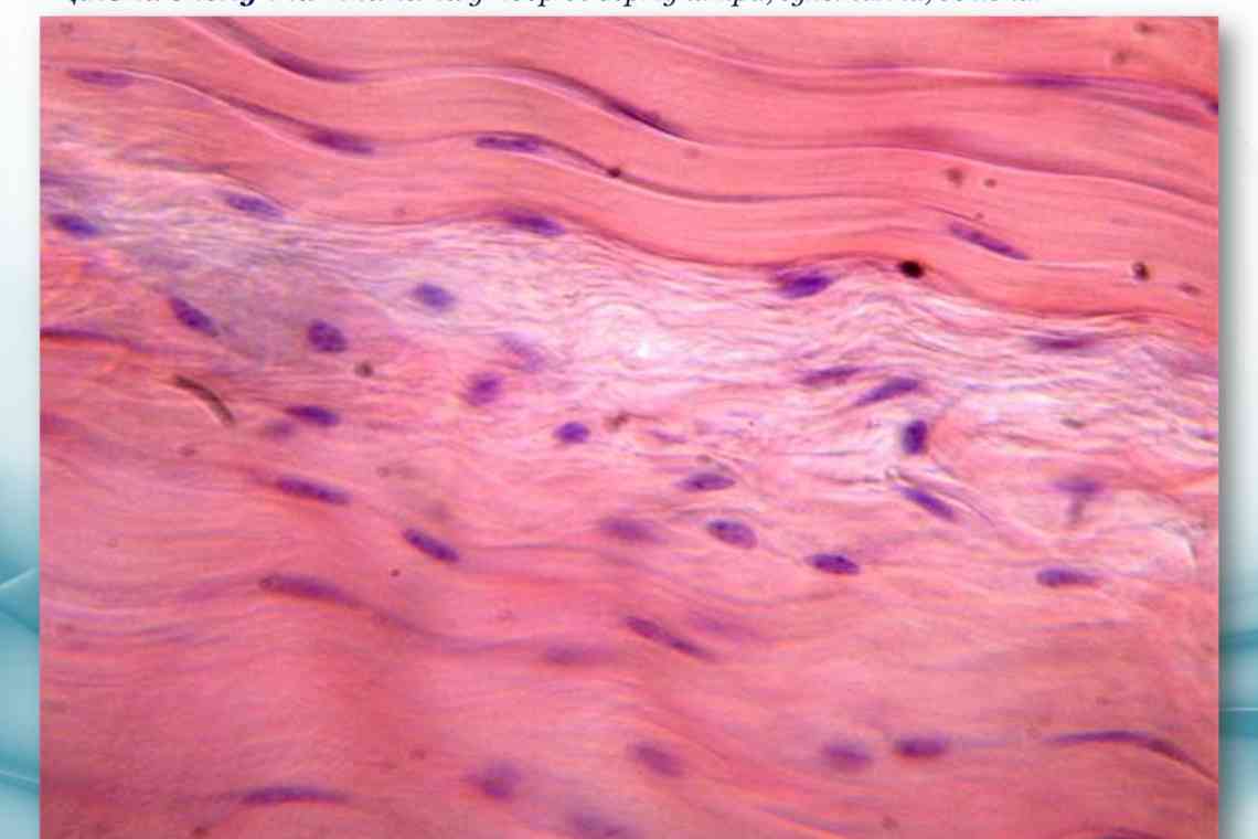 Міозит, або запалення м'язової тканини: як розпізнати і чим боротися?