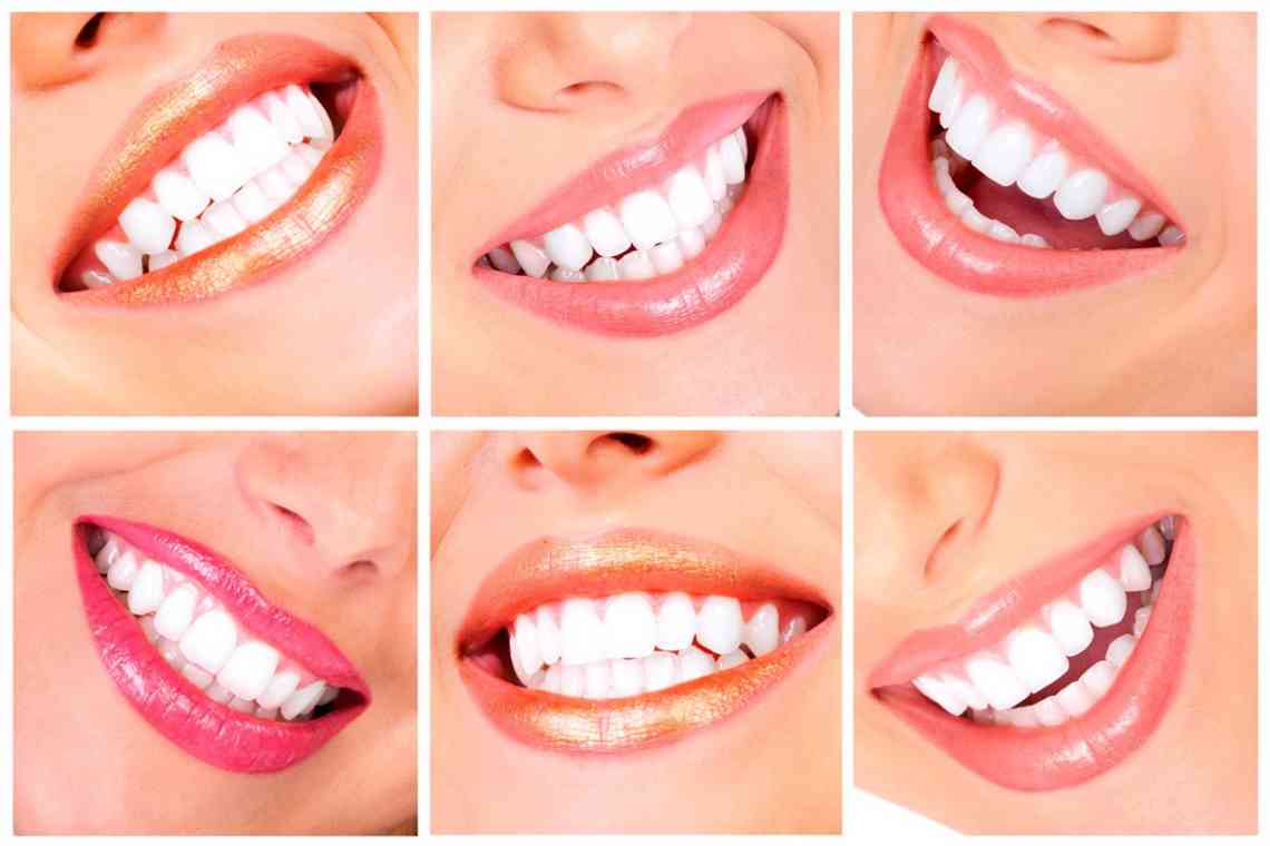 Чи реально зміцнити зуби в домашніх умовах?