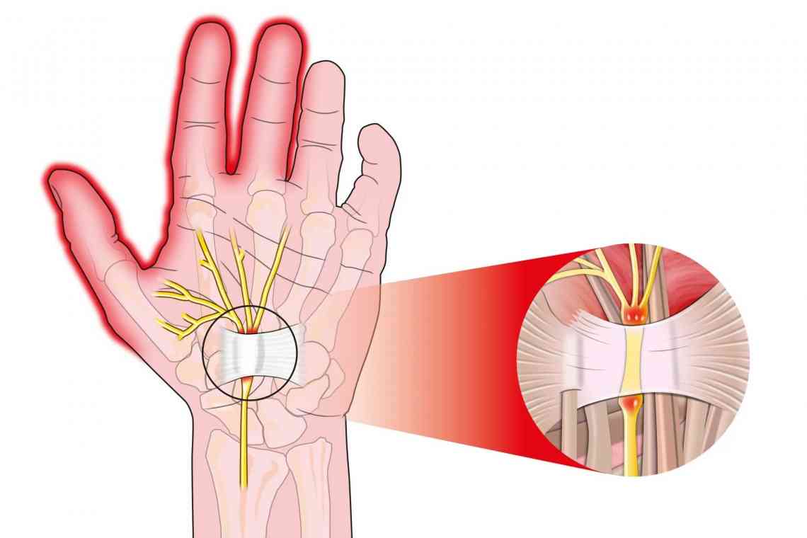 Що зробити, якщо болить суглоб вказівного пальця?