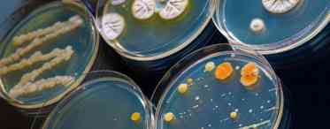 Як правильно посіяти культуру бактерій